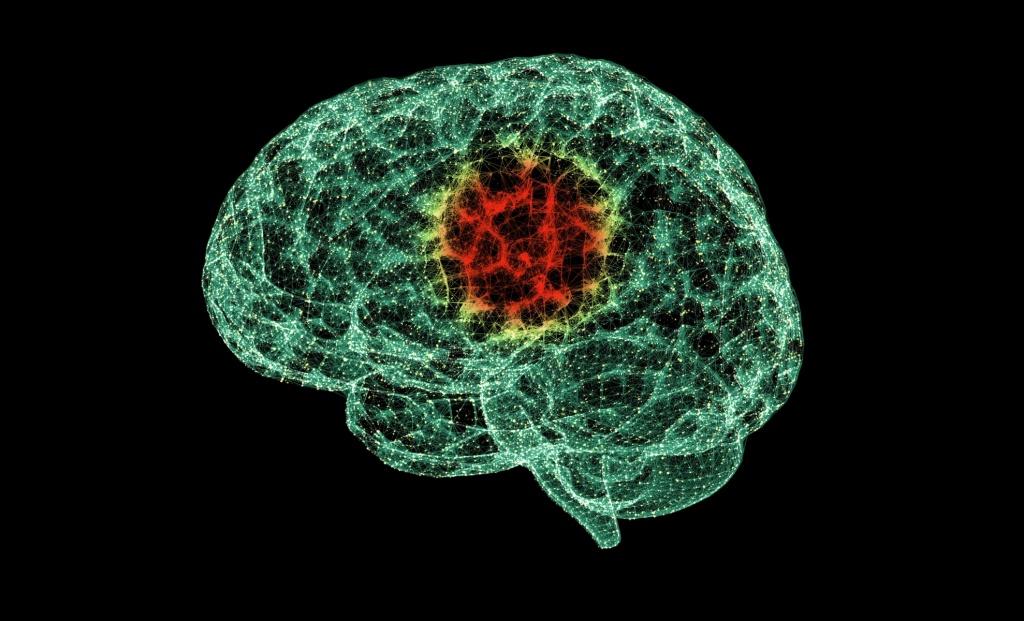 нейропсихологическое обследование